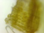Image18176 Scalp thing ... (Click to enlarge)