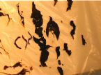 11 IntestinalFlushLook1 ... (Click to enlarge)