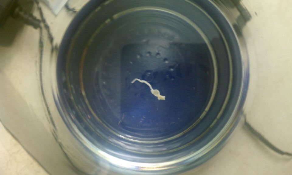 Nasal roundworm at Parasites Support Forum (Alt Med), with image