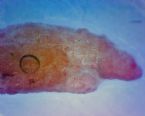 assumed liver fluke ... (Click to enlarge)