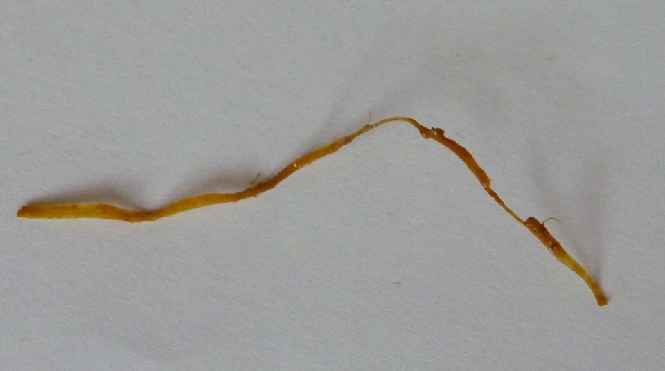 Is this a worm? 3 inches long in my stool. Is this a worm? 3 inches long in my stool.