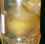 Tapeworm Solex