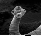Scolex:  tapeworm Head