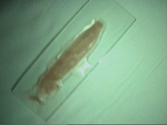 Image: WORM SEGMENT Image: WORM SEGMENT