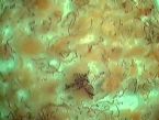 1-3-09 Zapped Liver Fluke Eggs ... (Click to enlarge)