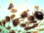 More fluke eggs ... (Click to enlarge)