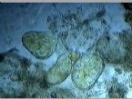 5-14-10  stool eggs ... (Click to enlarge)