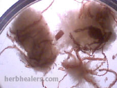 //www.curezone.org/upload/Parasites/egg15.jpg