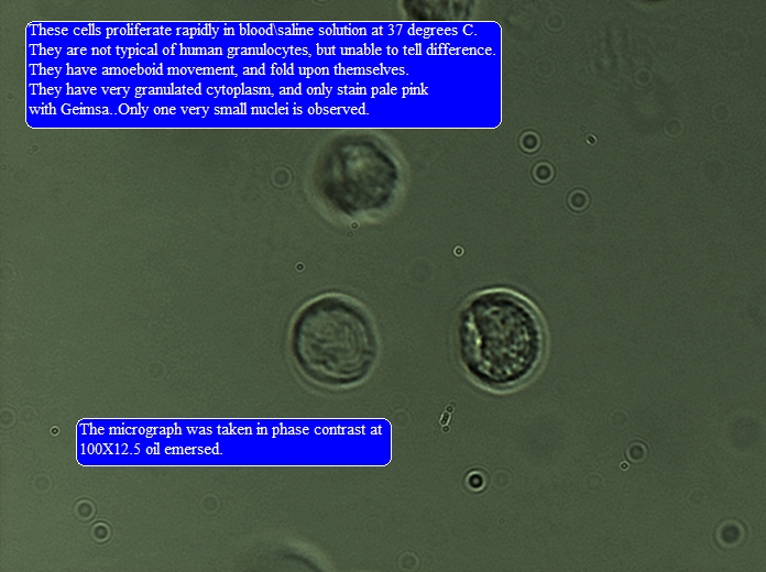 Image: blastocystis in blood Image: blastocystis in blood