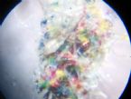 002gel like and colorful fibers coming from scalp