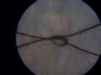 023 shoulder fiber ... (Click to enlarge)