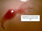 from nose as blood clot - rinsed in water ... (Click to enlarge)