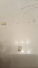 help! Found this in my mothers poop 7 ... (Click to enlarge)