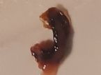 Bllood sucking nasal parasite