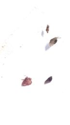 Parasites from skin soresADBF 48D4530A1997 ... (Click to enlarge)