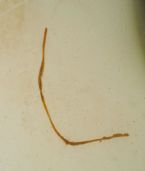 ROUNDWORM? ... (Click to enlarge)