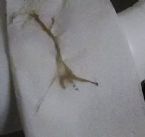 SINUS PARASITE ... (Click to enlarge)