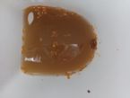 Parasites - Internal zoo - Flukes?