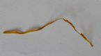 Is this a worm? 3 inches long in my stool. ... (Click to enlarge)