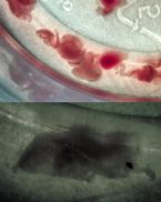Critters extracted from face, chronic sores