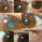 EYE can see ... this aint normal!