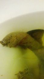Blood flukes in poop?? ... (Click to enlarge)
