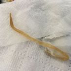 Candida or worm? ... (Click to enlarge)