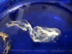 parasite from stool on blue plate ... (Click to enlarge)