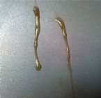 sticky stuff ... (Click to enlarge)