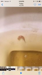 parasite found in urine! ... (Click to enlarge)
