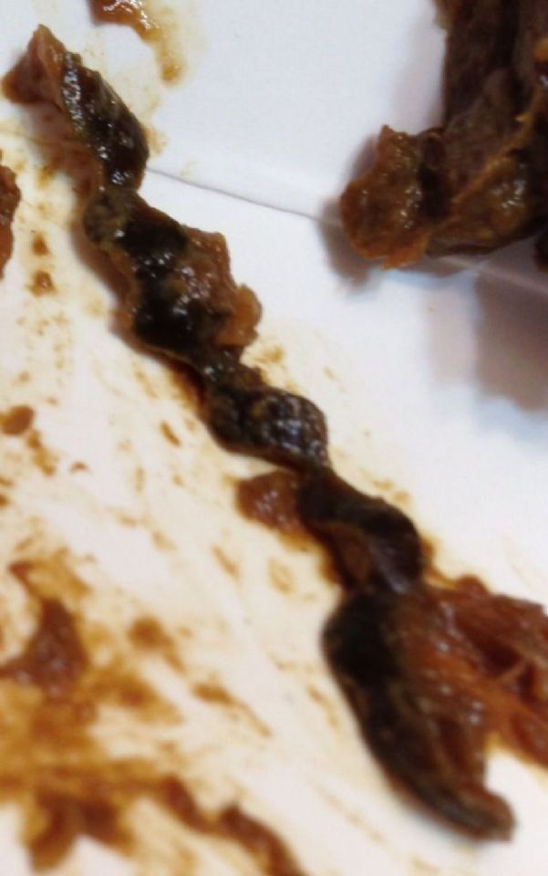 pin worms poop