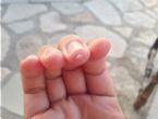 0002 skin pockets on fingertips ... (Click to enlarge)