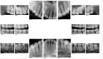 teeth