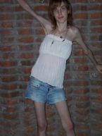 anorexia photo 008
