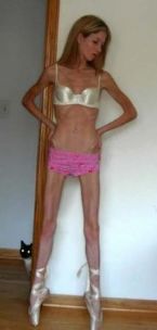 anorexia photo 010 ... (Click to enlarge)