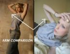anorexia photo 016