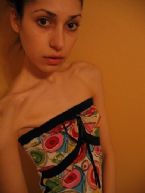 anorexia photo 028
