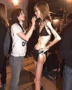 anorexia photo 045