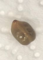 Possible parasite 1
