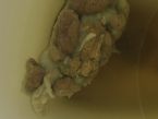 Parasite or candida #2 ... (Click to enlarge)