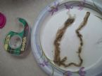 Ascaris Roundworm? ... (Click to enlarge)