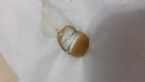 02 What is this in my stool?? smooth, gelatinous, pebble or pod shaped,crumbly inside ... (Click to enlarge)