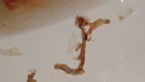 Intestinal Parasites ... (Click to enlarge)