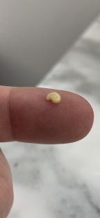 Worm Egg ... (Click to enlarge)