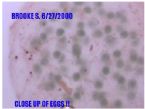 Rare Eggs ... (Click to enlarge)