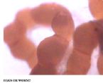 close up eggs ... (Click to enlarge)