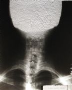 neck