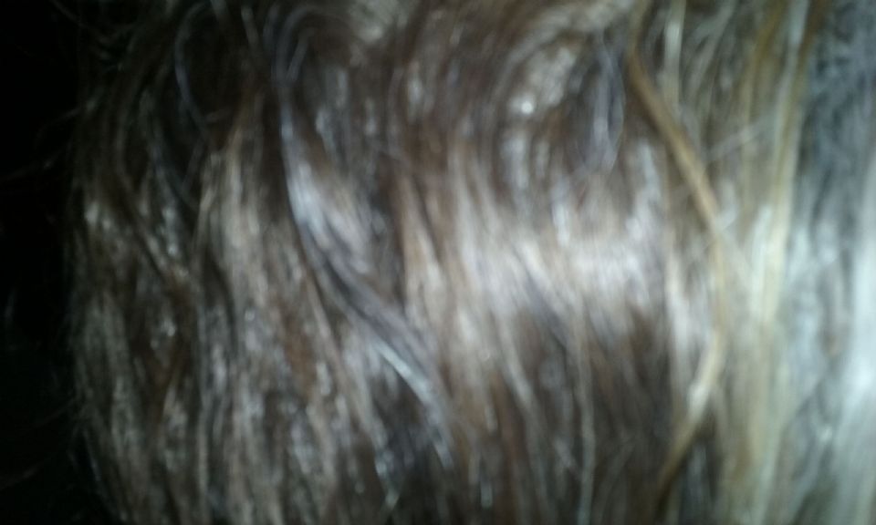 Image: fungi critters in my hair? or Magellons? Image: fungi critters in my hair? or Magellons?