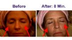 Remarkable results in just 8 minutes!