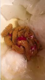 Blood in my stool, please help ... (Click to enlarge)